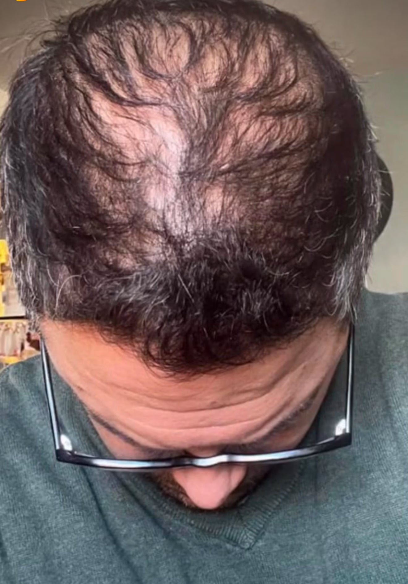 black and white
